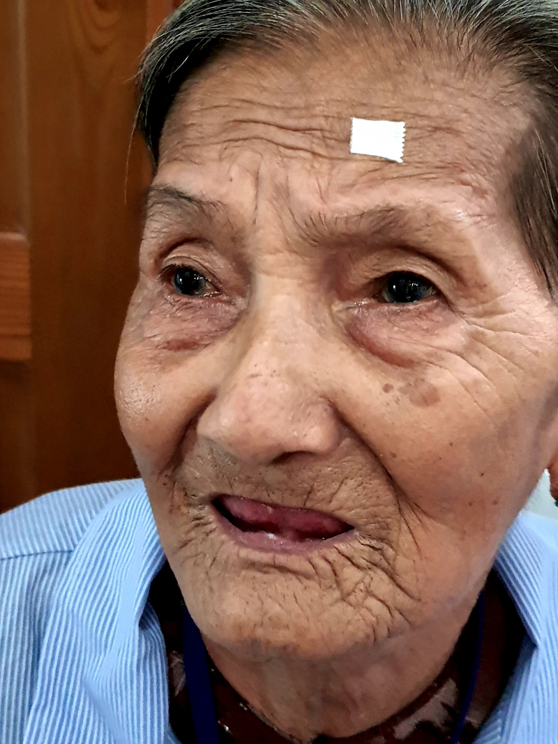 HOẠT ĐỘNG MỔ MẮT