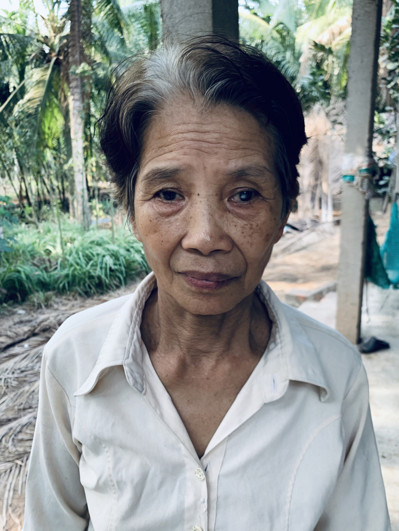 HOẠT ĐỘNG MỔ MẮT