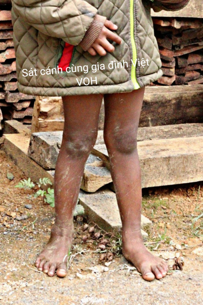 VẬN ĐỘNG CHƯƠNG TRÌNH TRUNG THU “VẼ GIẤC MƠ CHO EM”